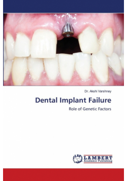 Dental Implant Failure