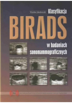 Klasyfikacja birads w badaniach sonograficznych