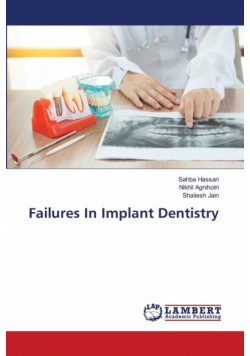 Failures In Implant Dentistry