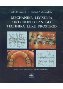 Mechanika leczenia ortodontycznego techniką łuku prostego