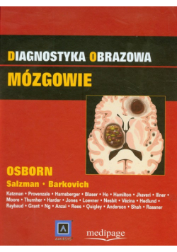 Diagnostyka obrazowa Mózgowie