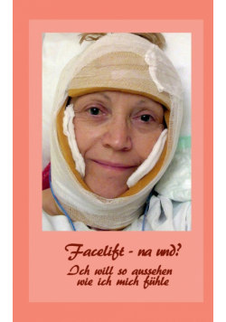 Facelift - na und?