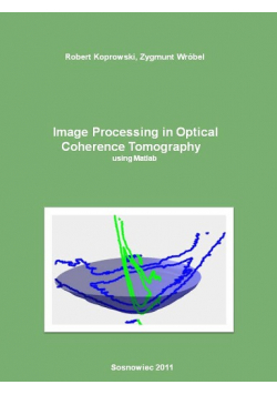 Image Processing in Optical Coherence Tomography