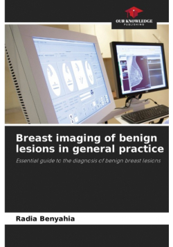 Breast imaging of benign lesions in general practice
