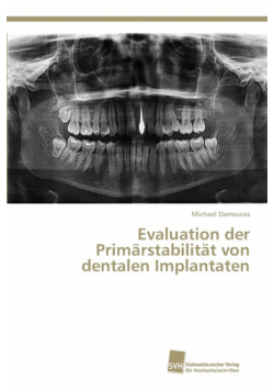 Evaluation der Primärstabilität von dentalen Implantaten