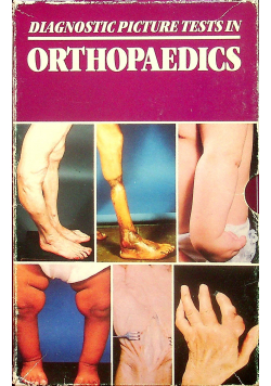 Diagnostic picture tests in orthopaedics