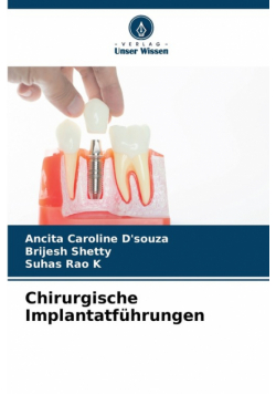 Chirurgische Implantatführungen