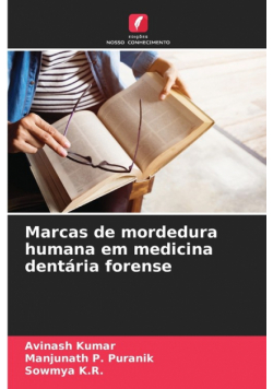 Marcas de mordedura humana em medicina dentária forense