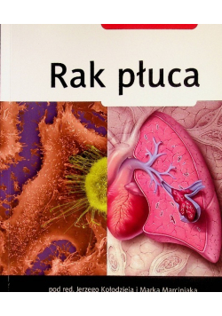 Rak płuca