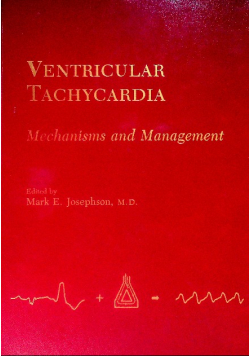 Ventricular Tachycardia