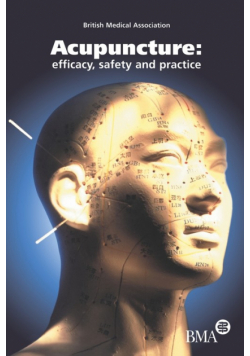 Acupuncture