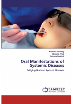 Oral Manifestations of Systemic Diseases