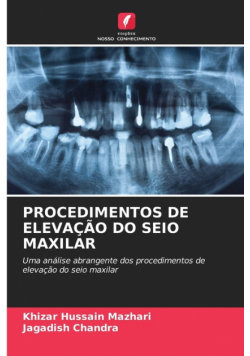 Procedimentos De Elevação Do Seio Maxilar