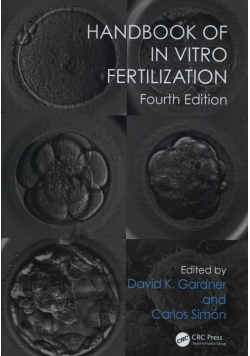 Handbook of In Vitro Fertilization
