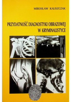 Przydatność diagnostyki obrazowej w kryminalistyce