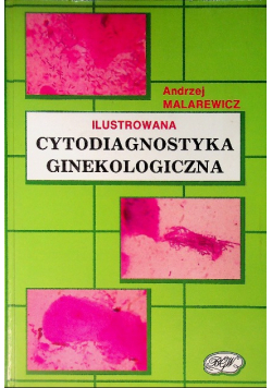 Ilustrowana cytodiagnostyka ginekologiczna