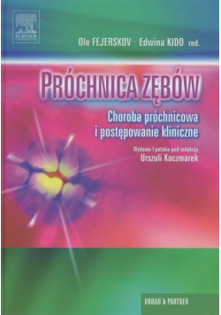 Próchnica zębów