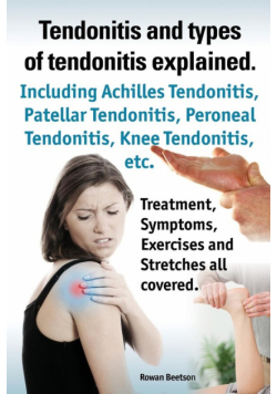 Tendonitis and the Different Types of Tendonitis Explained. Tendonitis Symptoms, Diagnosis, Treatment Options, Stretches and Exercises All Included.
