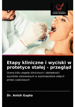 Etapy kliniczne i wyciski w protetyce stałej - przegląd
