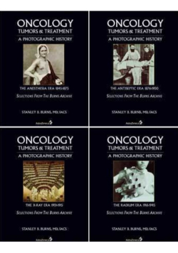 Oncology Tumors & Treatment Tom 1 do 4