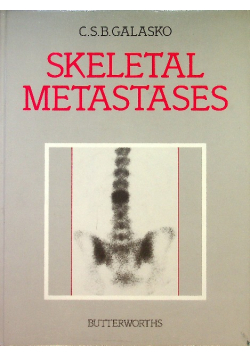 Skeletal Metastases