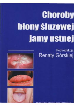 Górska choroby błony śluzowej jamy ustnej