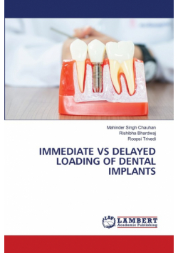 Immediate Vs Delayed Loading Of Dental Implants