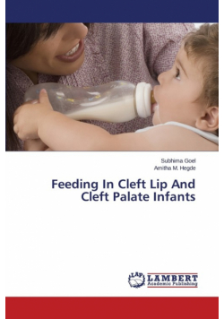 Feeding In Cleft Lip And Cleft Palate Infants