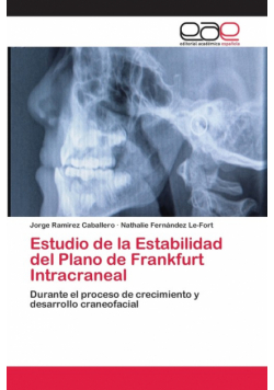 Estudio de la Estabilidad del Plano de Frankfurt Intracraneal