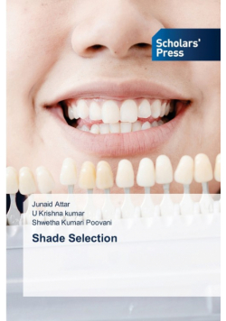 Shade Selection
