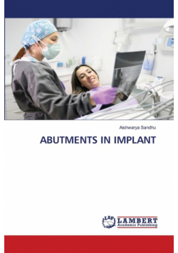 Abutments In Implant