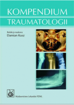 Kompendium traumatologii