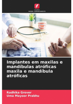 Implantes em maxilas e mandíbulas atróficas maxila e mandíbula atróficas
