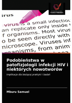 Podobieństwa w patofizjologii infekcji HIV i niektórych nowotworów