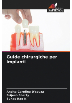 Guide chirurgiche per impianti