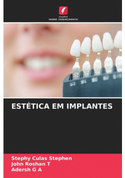 Estética Em Implantes