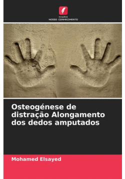 Osteogénese de distração Alongamento dos dedos amputados