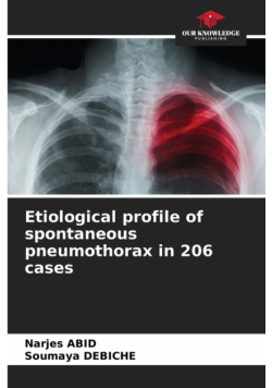 Etiological profile of spontaneous pneumothorax in 206 cases