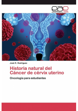 Historia natural del Cáncer de cérvix uterino
