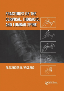 Fractures of the Cervical, Thoracic, and Lumbar Spine