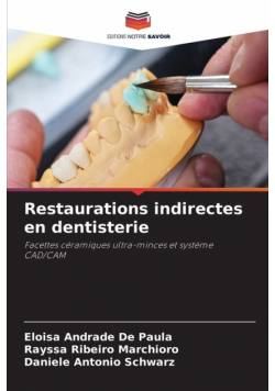 Restaurations indirectes en dentisterie