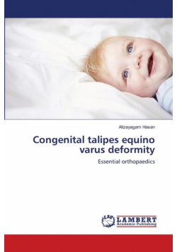 Congenital talipes equino varus deformity