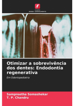 Otimizar a sobrevivência dos dentes
