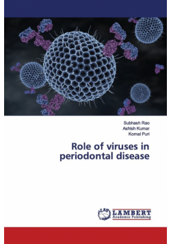 Role of viruses in periodontal disease