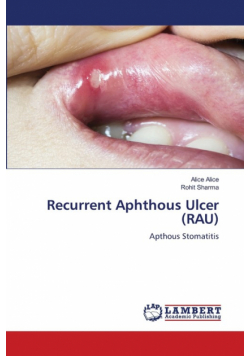 Recurrent Aphthous Ulcer (RAU)
