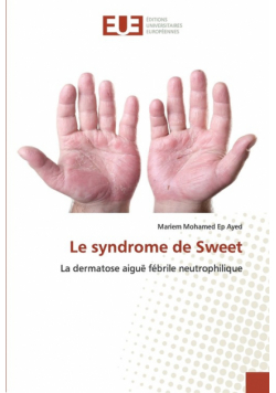 Le syndrome de Sweet