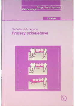 Protezy szkieletowe
