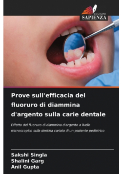 Prove sull'efficacia del fluoruro di diammina d'argento sulla carie dentale