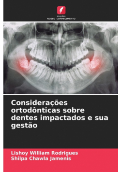 Considerações ortodônticas sobre dentes impactados e sua gestão