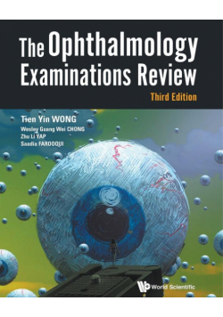 The Ophthalmology Examinations Review